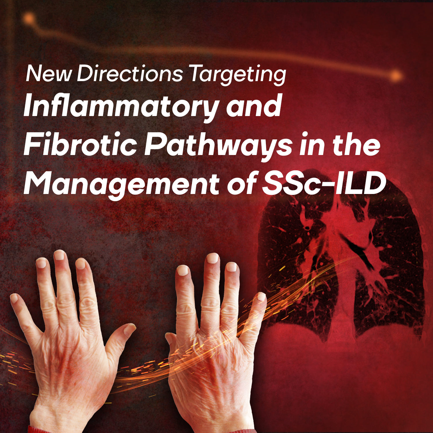 New Directions Targeting Inflammatory and Fibrotic Pathways in the Mgmt of SSc-ILD