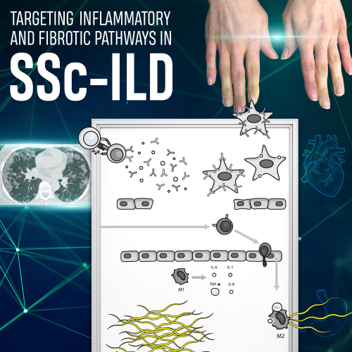 targeting-inflammatory-and-fibrotic-pathways-in-ssc-ild