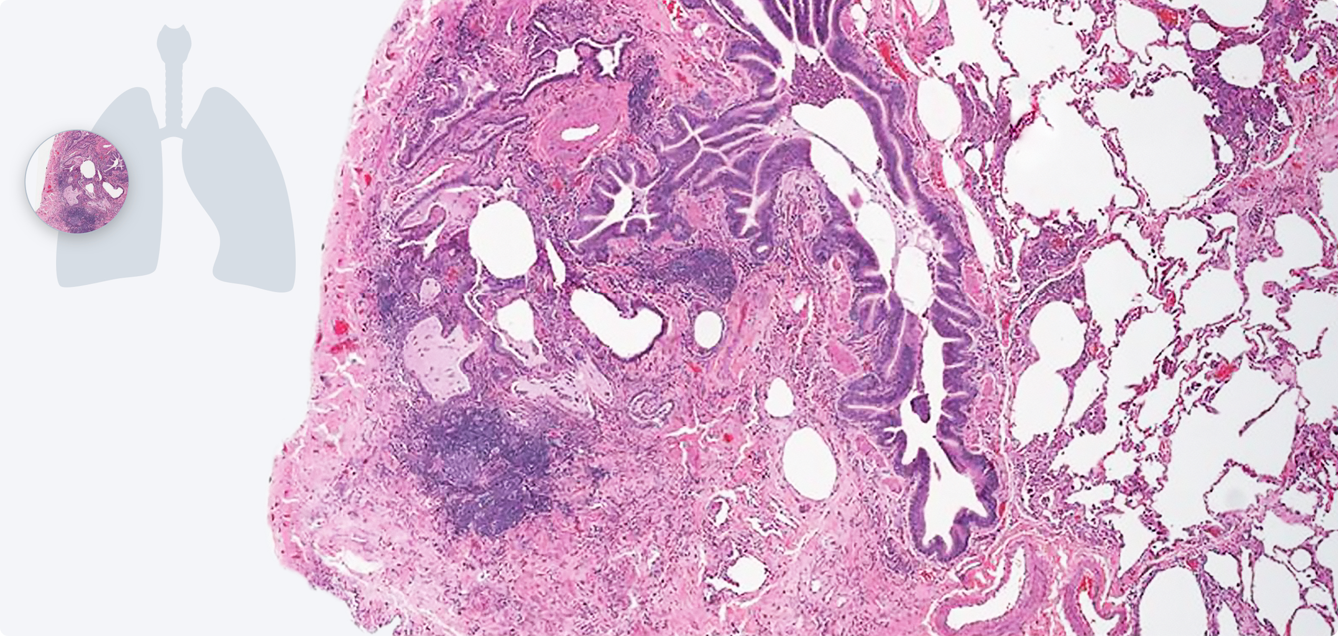 cross-section diagram of a lung